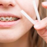 矯正ワックスがすぐ取れる原因と正しい付け方！外れないコツを徹底解説
