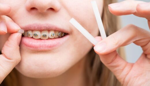 矯正ワックスがすぐ取れる原因と正しい付け方！外れないコツを徹底解説